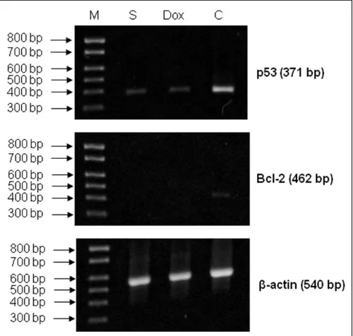 FIG. 1: ELECTROPHORETIC BANDS OF RT-PCR PRODUCT. M- DNA molecular size marker; S- Sample; Dox- Doxorubicin; C- Medium control 