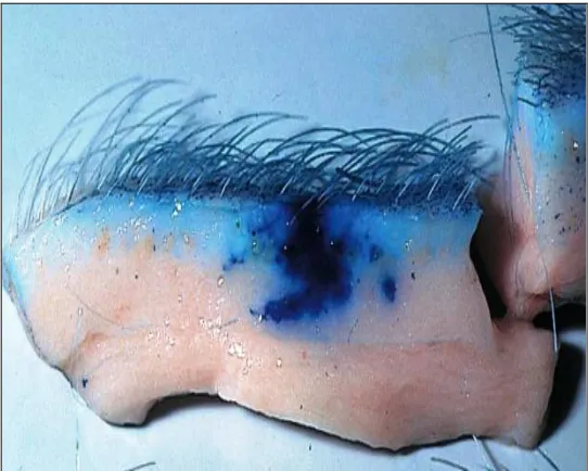 FIGURE 6: DISTRIBUTION OF METHYLENE BLUE IN THE SKIN AND  UNDERLYING TISSUE FOLLOWING INJECTION WITH A NEEDLE-FREE INJECTION DEVICE