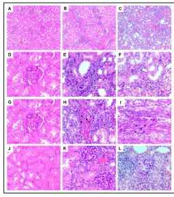 Figure 5. Histological sections of the renal tissue of the animals of  the experimental groups CG (A, D, G and J), NG (B, E, H and K) and NG + MSC (C, F, I and L)