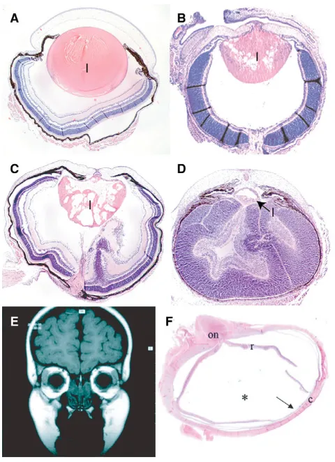 Fig. 2. A comparison of wild-type and Foxe3 showing the absence of the lens (arrow). The asterisk indicates theempty cavity, most likely corresponding to the vitreous