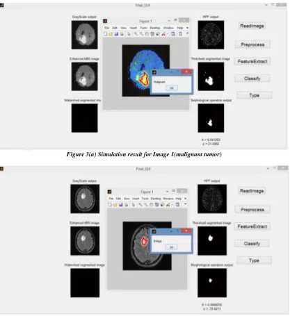 Figure 3(a) Simulation result for Image 1(malignant tumor) 