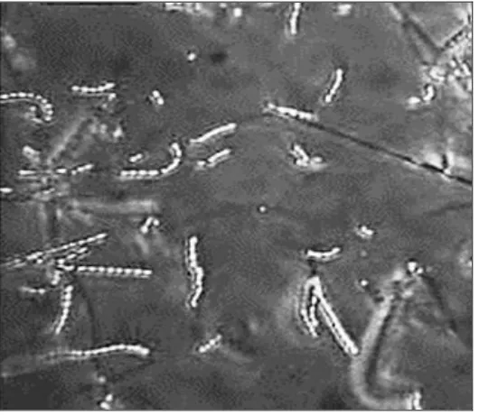 FIG. 7: SPORE CHAIN STRUCTURE OF ISOLATED ACTINOMYCETES SP. A2 OBSERVED UNDER 