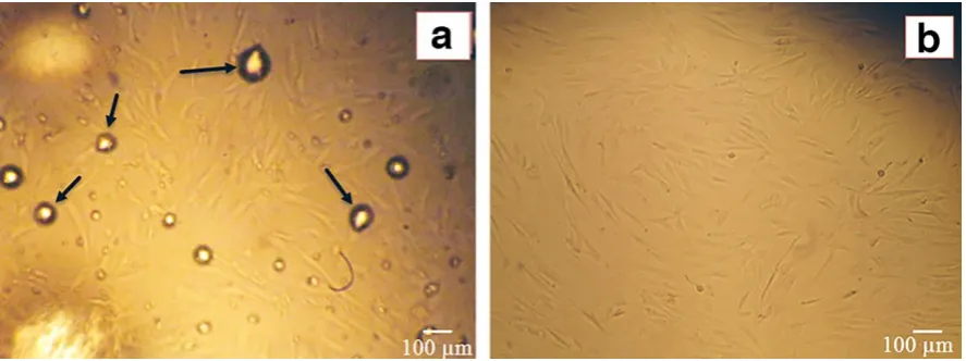 Fig. 1. Isolated ADSCs with the enzymatic method from lipoaspirate samples. (A). Following a 48- hour SVF culture, fibroblast-like spindle shape cells can be clearly observed (100x).The arrows indicate the remains of oil spots from digested fat