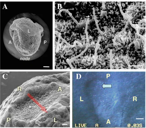 Fig. 1. Mechanisms of left-right (LR) patterning in mouse embryo. (A) Three steps in the generation of LR asymmetry: a symmetry-breaking eventin the node, the patterning of the lateral plate mesoderm (LPM) and asymmetric organogenesis