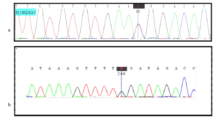Fig 4. BRCA sequencing results. a: sequence graph of the region surrounding the exon 18 of BRCA1 c.5158C>T mutation in the patient (5158C/T heterozygous); b: DNA sequencing of BRCA2 exon 25 identified a heterozygous BRCA2 mutation (c.9317G>A) in the patien
