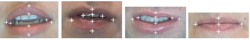 Figure 12: Examples of detected feature points.