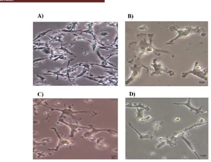 Fig. 1. Morphological features of PBMSCs treated with Noggin. A) Prior to treatment, PBMSCs showed fibroblast like shape on day 6