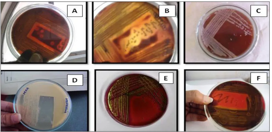 FIGURE 1: PURE BACTERIAL CULTURES OF GRAM POSITIVE BACTERIA (A)  C. pyogenes, (B) S. aureus, (C) S
