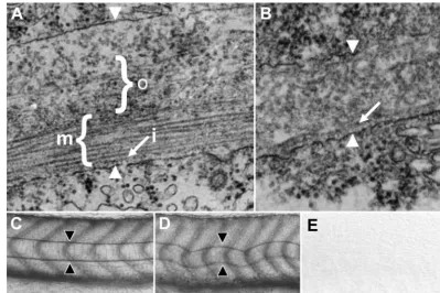 Fig. 5. Peri-notochordalbasement membrane. (A) The