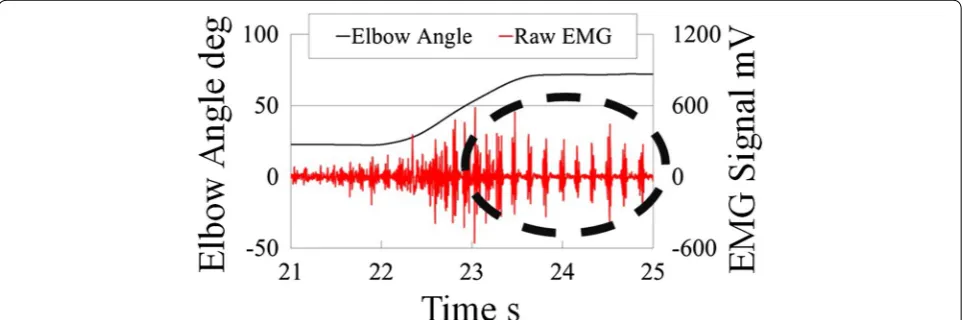 Fig. 2 Features of the EMG signals of essential tremor patients. These signals were measured from biceps brachii of real essential tremor patients when they performed elbow flexion