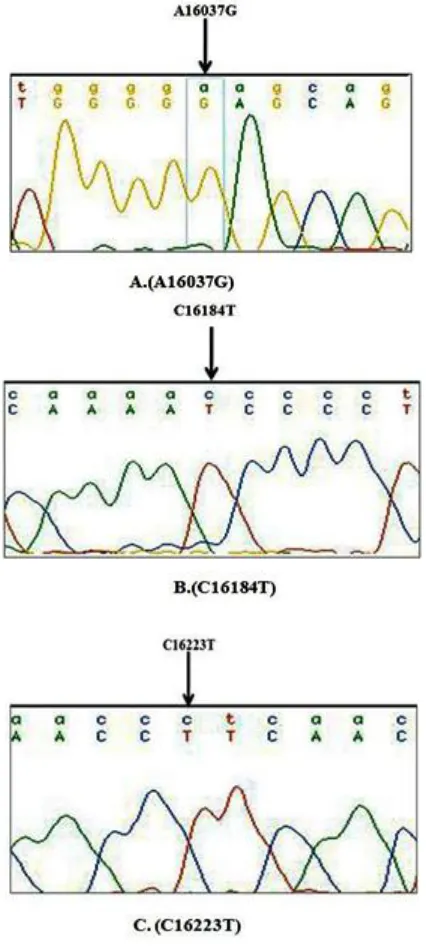 FIGURE 3: THE SEQUENCE ELECTROPHEROGRAM OF mtDNA POLYMORPHISMS OBSERVED. A. The wild type sequence showing (arrow) ‘A’ at the nucleotide position 16037