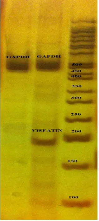 Table.1. sequences of primers for RT-PCR.
