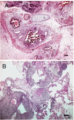 Fig. 2. Spontaneous differentiation of human ES cells.(A) Micrograph of a Hematoxylin and Eosin-stained section of atypical teratoma following the grafting of human ES cells into thetestis capsule of immunodeﬁcient mice, showing the presence ofcartilage (1