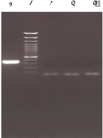Fig 2. Gel electrophoresis for  evaluation c.196C>T polymorphism in MAPK8IP2 gene. Lane 1: molecular weight  marker (50bp); Lane 2: wisdom tooth follicle; Lane 3: Ameloblastoma; Lane 4: Ameloblastic Carcinoma; Lane 5: Undigested PCR product (210bp)