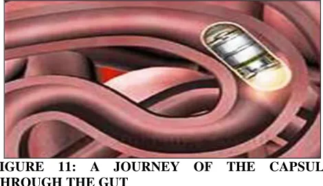 FIGURE 11: A JOURNEY OF THE CAPSULE  THROUGH THE GUT 