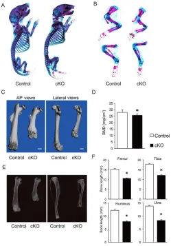 Fig. 1. Skeletal phenotypes in limb-specific Uhrf1are shown. (B) Higher magnification of skeletal preparation for forelimbs(upper panels) and hindlimbs (lower panels)