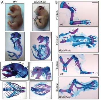 Fig. 4. Gpr161 determines endochondral andintramembranous bone formation.