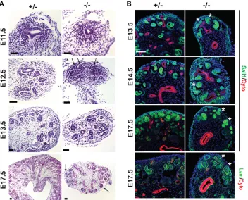 Fig. 2. Ectopic differentiated structures inthe Sall1 mutant. (A) Histological analysis ofSall1GFP +/– and –/– kidneys