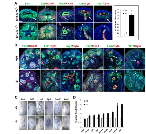 Fig. 3. Unrestrained differentiation in the Sall1an abnormal pattern of expression. (D) qRT-PCR for genes expressed in the RV, in stage-matched E11.5 +/– and E12.5 –/– shaped pattern (arrow) of presumptive podocytes is not apparent in the mutant (asterisk)