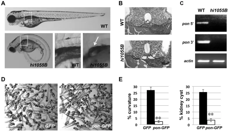 Fig. 1. Loss of function of Pontin leads to cilia-associated phenotypes in zebrafish. (A) A wild-type (WT) sibling and apooled per sample