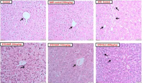 Fig. 3.  Naringenin restored normal hepatocyte morphology and architecture. H & E staining of liver (Mag 20x, Scale 50 μm) (a) control and naringenin only: normal histoarchitecture with normal central vein (arrow), (b) STZ only: severe distortion in tissue
