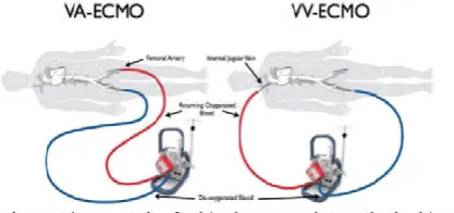 Fig. 1. Diagnoses of ECMO, Patients >17 years old 