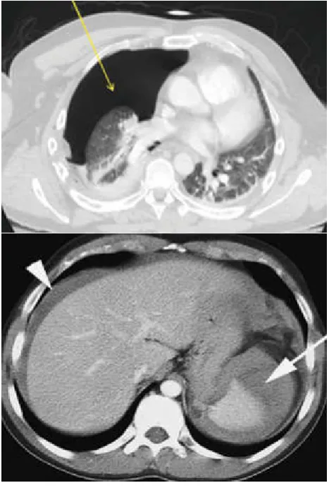 Fig. 4. CT scans 