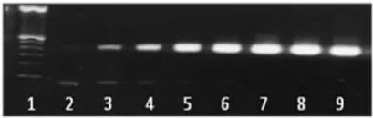 Fig. 1.  Agarose gel electrophoresis of serially diluted 100-106 C. albicans cells (100-106 CFU, corresponding to 10 ng to 10 fg-10 ng of DNA) showing a single, specific band at 500 bp
