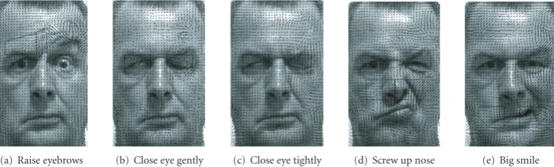 Figure 12: Results of optical ﬂow estimation on ﬁve frames with peak motion for a right palsy case.