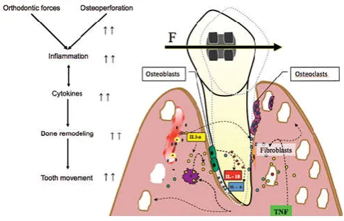 Figure 3. Regional acceleratory phenomenon 
