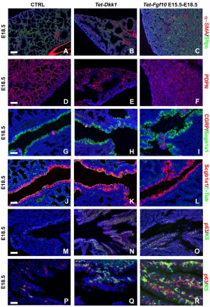 Fig. 7. Opposing and similar effects of Dkk1 andFgf10 on lung epithelial differentiation.(A-F) Immunostaining for α-SMA and Sftpc (A-C) or for