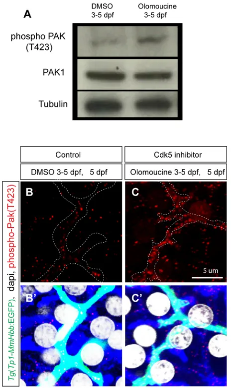 Fig. 3. Cdk5 regulates Pak1 activity in biliary epithelial cells. (A) Pak1phosphorylation (T423) levels in control DMSO-treated and olomoucine-treated wild-type Tg(Tp1-MmHbb:EGFP)um14 larvae were analyzed bywestern blotting at 5 dpf