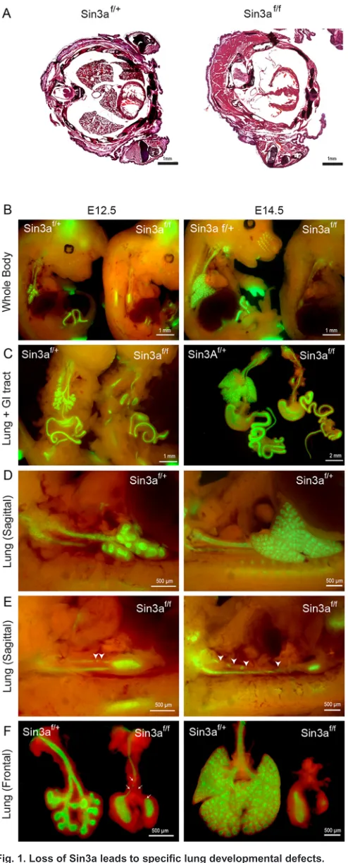 Fig. 1. Loss of Sin3a leads to specific lung developmental defects.(A) Hematoxylin and Eosin staining of thoracic transverse section of neonatal(P0) Sin3af/f (ShhCre/+;Sin3aflox/flox;Rosa-mTmG) mutant and Sin3af/+ (ShhCre/+;Sin3aflox/+;Rosa-mTmG) littermat