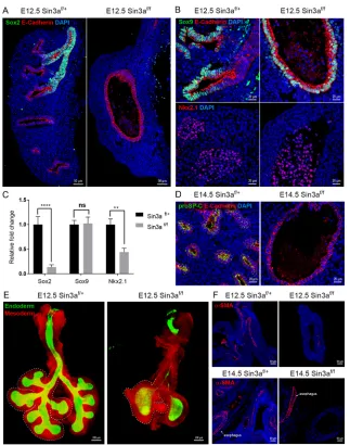 Fig. 4. Sin3a is required for branching morphogenesisand cell fate in the developing lung.