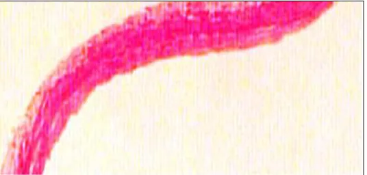 Fig. 2C shows pathological changes of thoracic aorta in HCD + CD groups were less visible than that in atherosclerotic group, but shown less thickening of the intima and foam cells count (100X)