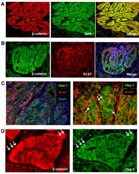 Fig. 6. Heterogeneity of colon tumour cells in ApcMin/+mouse. (A) Double immunostaining for β-catenin (red) andGFP (green) in the colon tumour of ApcMin/+ mouse withtransgenic GFP reporter allele for β-catenin/Tcf transcriptionactivity