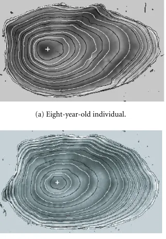 Figure 10: Inﬂation of the current ring for next ring detection.