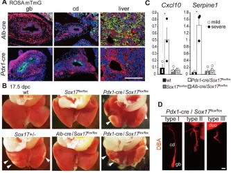 Fig. 3. Embryonic hepatitis can be induced by conditional Sox17Serpine1Sox17 deletion in primordial gallbladder but not in liver hepatoblasts