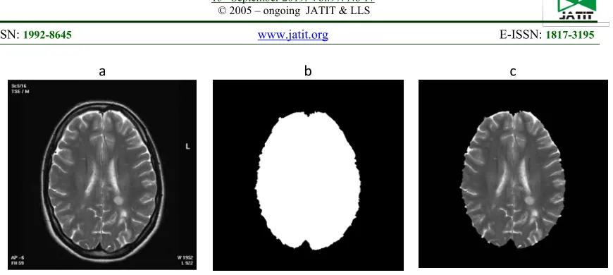 Figure 3: Steps Of Removing Unwanted Background. 