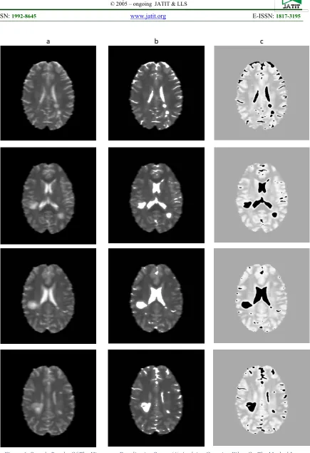 Figure 6: Sample Results Of The Histogram Equalization Stage. (A) Applying Gaussian Filter On The Masked Image,  (B) Results Of Contrast Enhancement On The Filtered Image, And (C) Applying Histogram Equalization