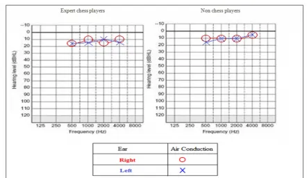Fig. 1. Auditory Threshold Average in Different Frequencies (horizontal axis) based on dBHL (vertical axis) in EachGroup