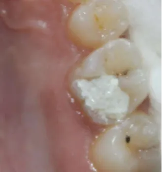 Fig. 2. 1. Pre-operative photograph  