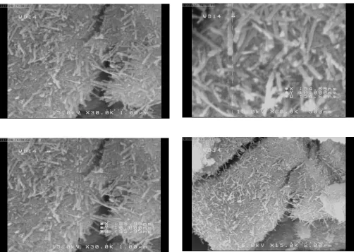 Fig. 4. SEM surface properties of Porous Activated carbon              after imobilization