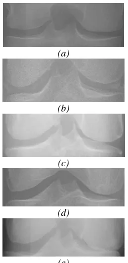 Figure 2. Data Junction Space Area (JSA)  (e) (a) grade 0 (b) grade 1(c) grade 2 (d) grade 3 