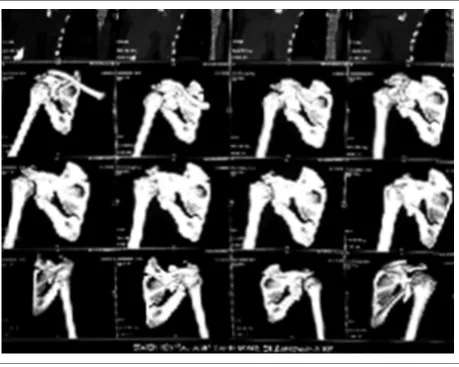 Figure 5. Range of Motion at Subsequent Visits