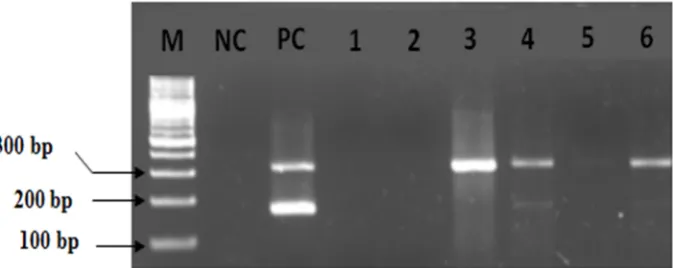 Fig.1. Analysis of 2% agarose gel. From left to right, lanes contain marker, negative control, positive control and follow-ing six clinical samples suspected of having pulmonary tuberculosis