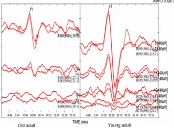 Fig. 1. The cervical vestibular evoked myogenic potentials recorded in the right ear of a youngand an old adult at 95 dB nHL and threshold intensity level.