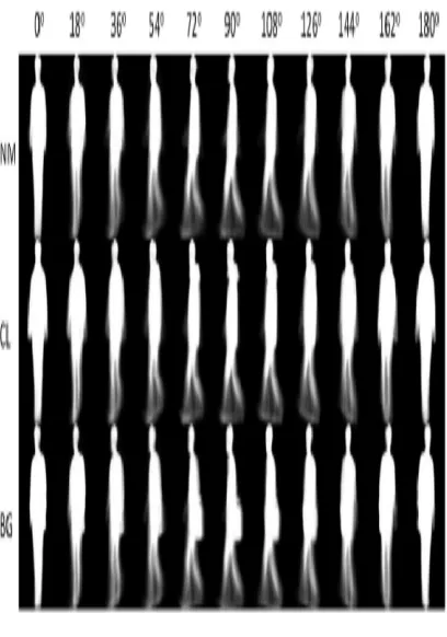 Figure 3  Examples for all views in CASIA gait database (dataset B)   [19] 
