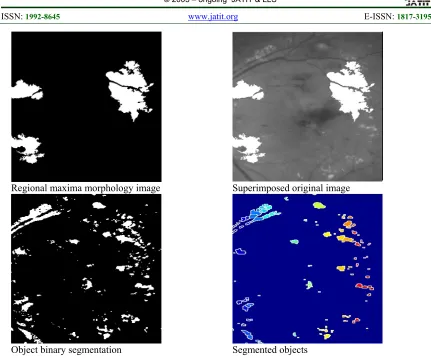 Figure 6: Implementation results of watershed marker-extraction algorithm, initial stage of CPM