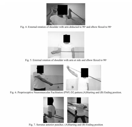 Fig. 4. External rotation of shoulder with arm abducted to 90ᵒ and elbow flexed to 90ᵒ